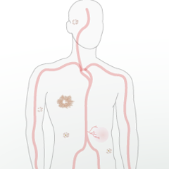 Images from Inside Cancer